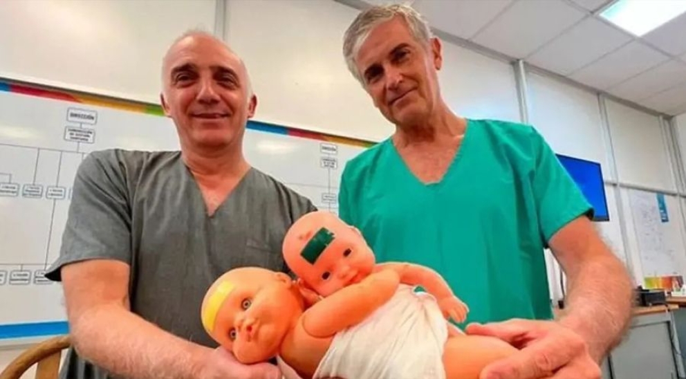 Separaron con éxito a siamesas que nacieron con el hígado y el intestino unido en Córdoba