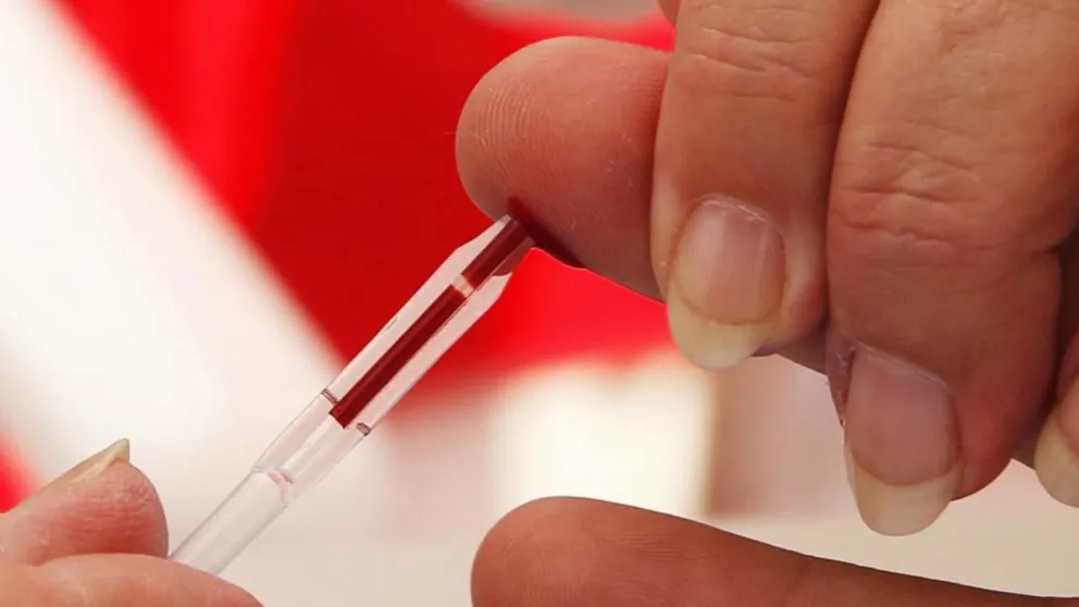 «Hacete el test. Sumá tu gotita», la campaña para promover el testeo de VIH