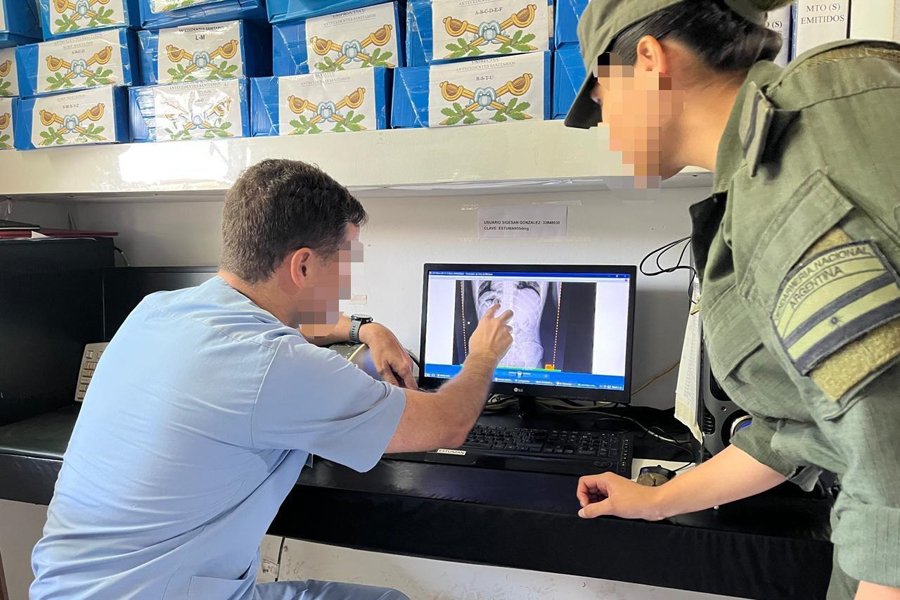 Viajaban sin equipaje y llamaron la atención: habían ingerido 431 cápsulas con cocaína