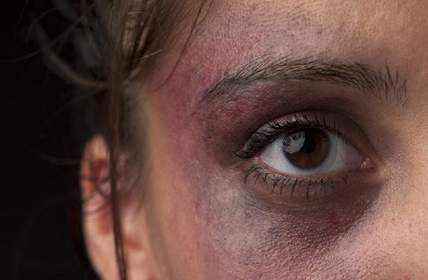 Comisario santiagueño aplicó una brutal golpiza a su novia, una empleada pública