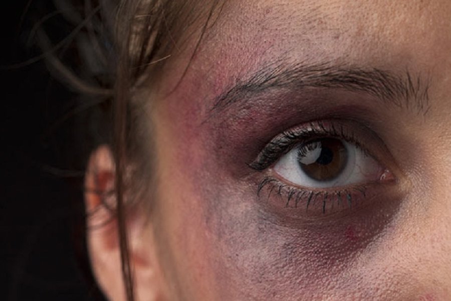 Comisario santiagueño aplicó una brutal golpiza a su novia, una empleada pública