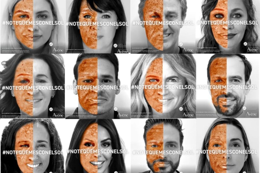 Día Mundial del Cáncer de Piel: el 90 % de los casos puede prevenirse con cuidados simples