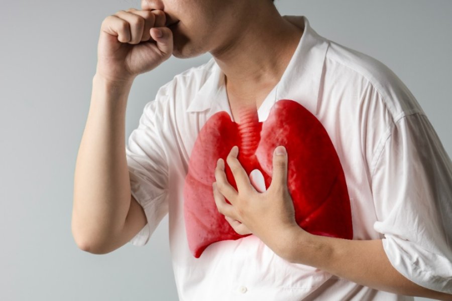Tuberculosis en Argentina: Los casos subieron un 38% y piden reforzar la vacunación