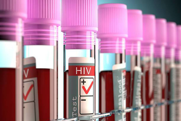 Denuncian falta de reactivos para detectar casos de VIH