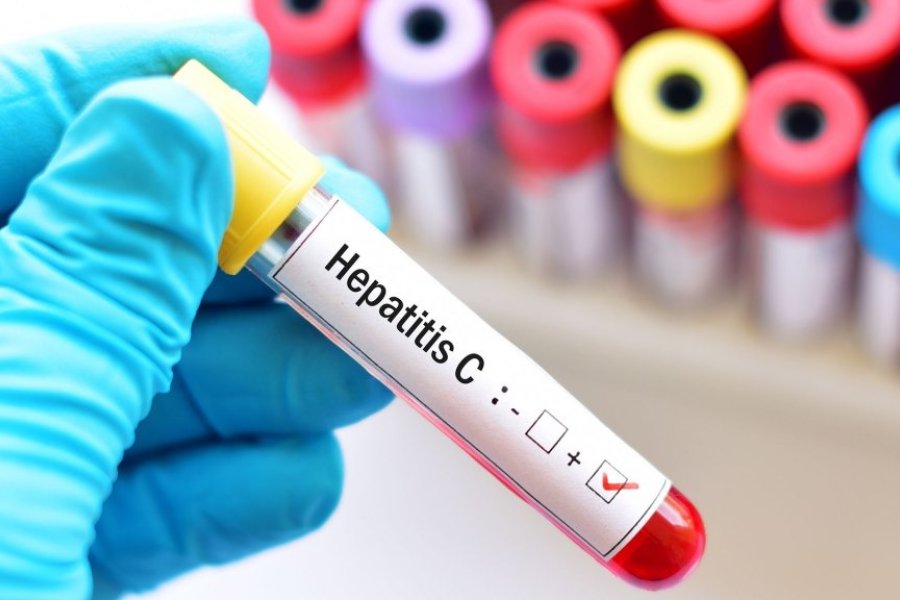 Prevención, vacunas y testeos, las claves contra las hepatitis virales