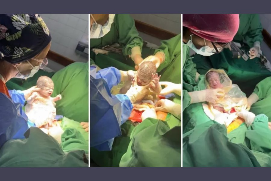 Nacieron trigemelas en Salta Nacieron trigemelas en Salta