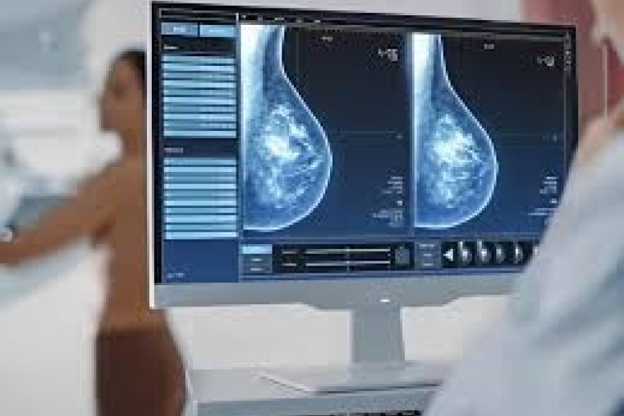 Detección temprana: Mañana realizarán mamografías gratuitas en el Barrio Parque Aguirre