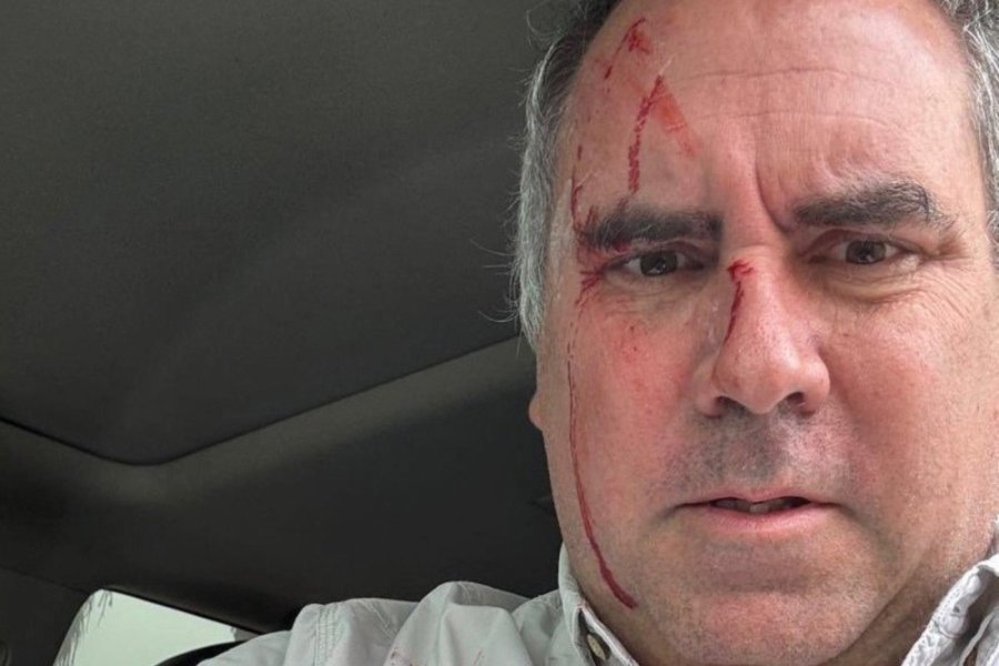 Atacaron a balazos a candidato presidencial en Perú: Rafael Belaúnde salió Ileso