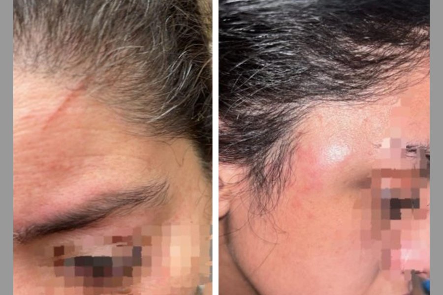 Nueva denuncia contra Sebastián Corti: Lo acusan de golpear a su pareja a días de ser excarcelado