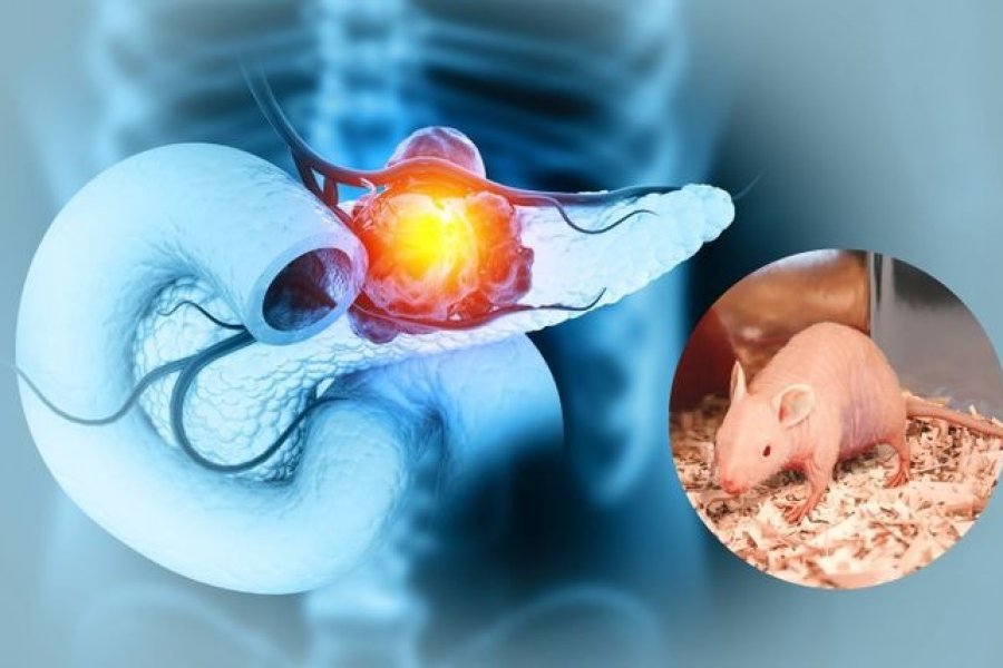 Hito científico: Logran erradicar el cáncer de páncreas en modelos animales Hito científico: Logran erradicar el cáncer de páncreas en modelos animales