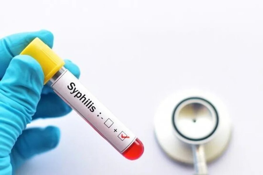 Alerta sanitaria: la sífilis alcanza su nivel más alto en años y preocupa el aumento en jóvenes