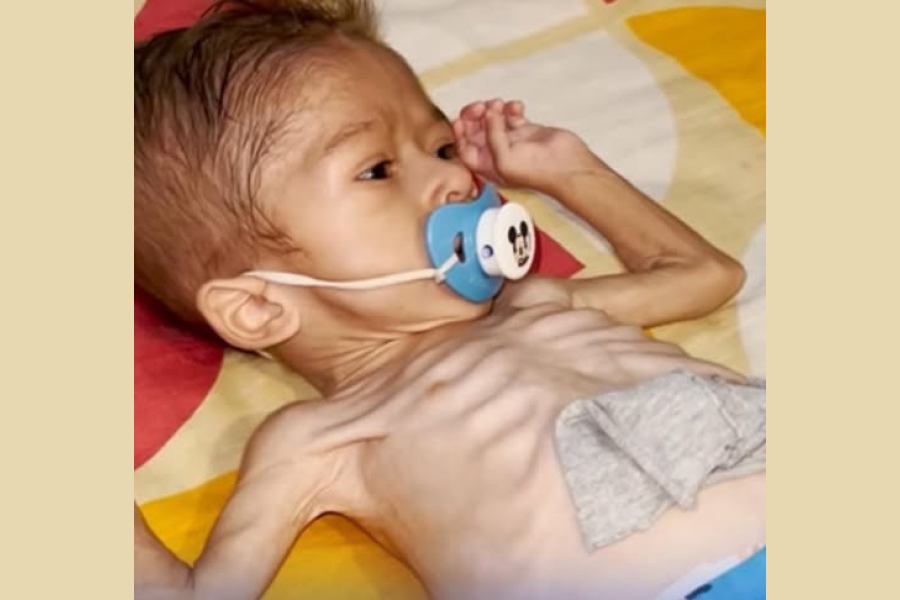 Historia de superación: Jonefert, el niño que venció un tumor de garganta y la desnutrición