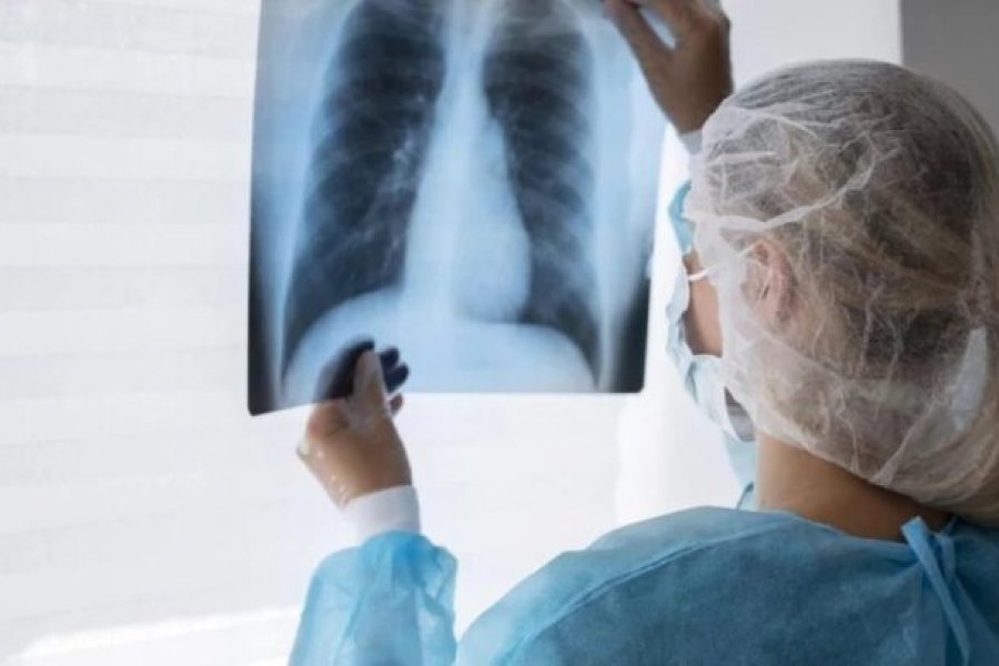 Alerta sanitaria: La tuberculosis crece con fuerza y afecta cada vez más a jóvenes