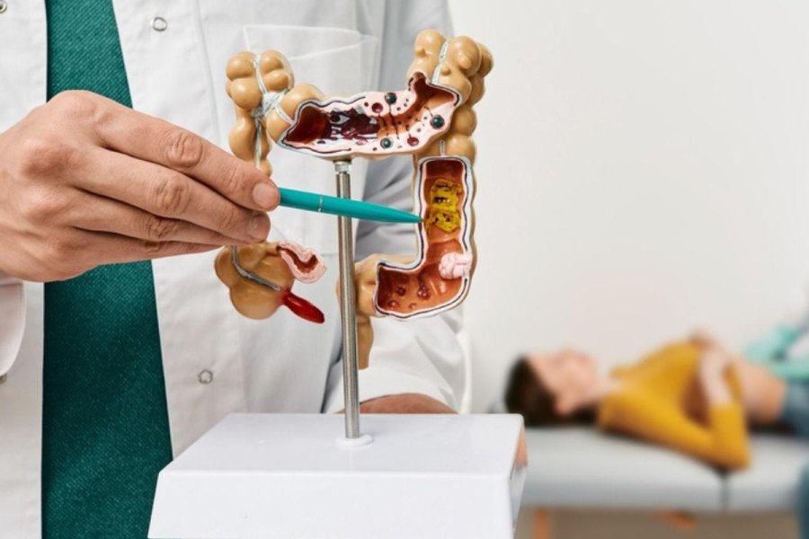 Qué alimentos ayudan a cuidar el colon y reducir el riesgo de cáncer colorrectal