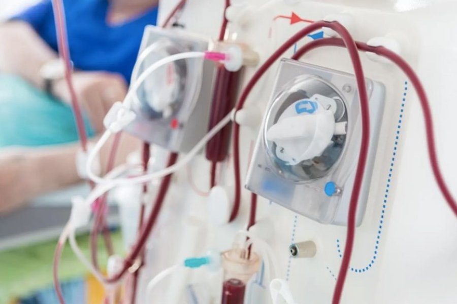Alerta por la salud renal en Argentina: 30.000 pacientes en diálisis y disparidad en la calidad de atención