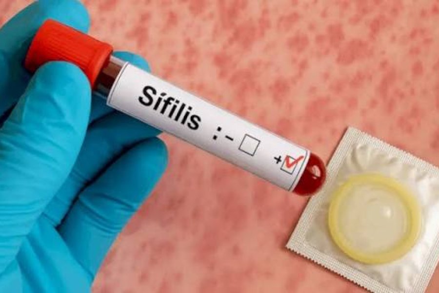 Alerta por el marcado aumento de casos de sífilis en Tucumán y en todo el país