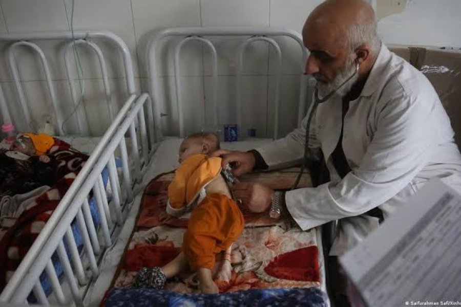 Alerta en Afganistán por un millón de niños en riesgo de muerte por malnutrición grave